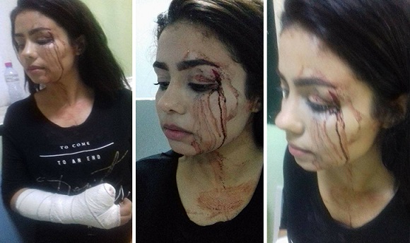 بسبب ازدحام في حركة المرور :  هذه المواطنة تعرّضت إلى اعتداء من قبل شخص أصرّت على أنه أمني 